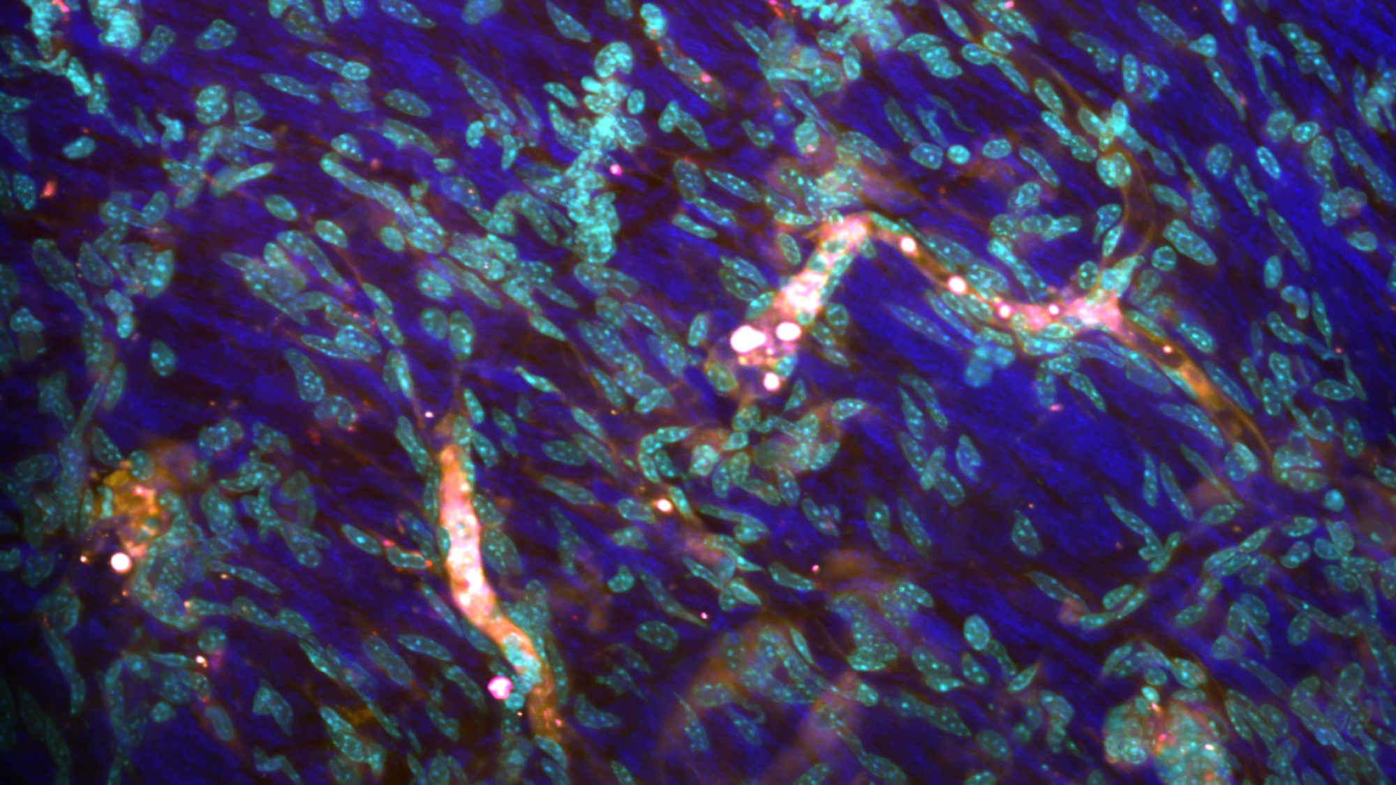 Nikon A1R HD-Multiphoton image.